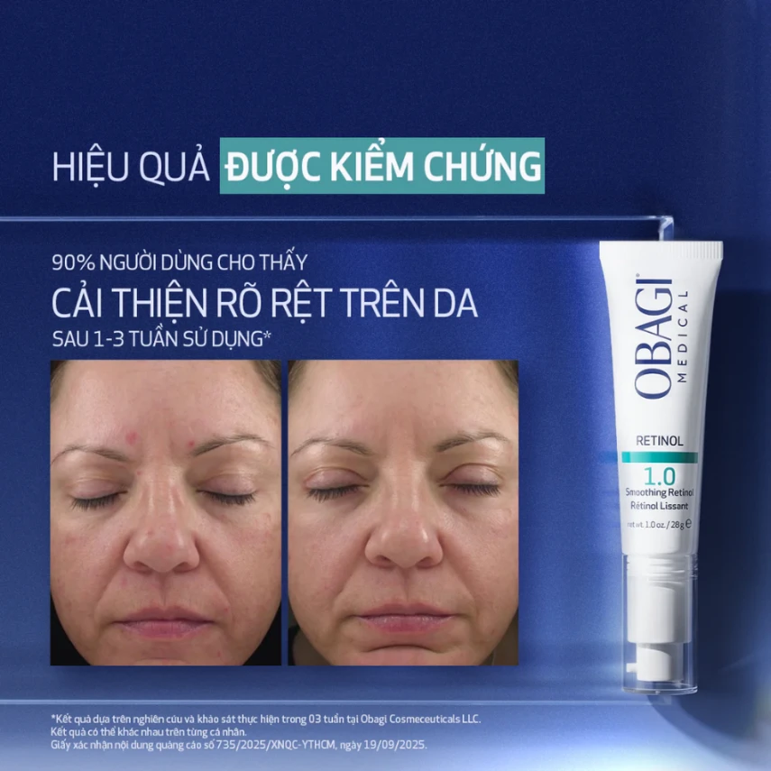 Kem dưỡng ẩm giảm nếp nhăn Obagi Retinol 1.0 28g - Ảnh 4